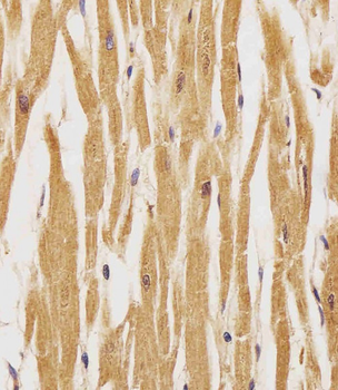 Phospho-HER4(Y1162) Antibody
