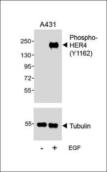 Phospho-HER4(Y1162) Antibody