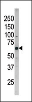 Phospho-CDC25B(S187) Antibody