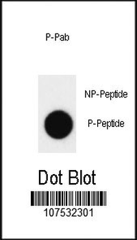 Phospho-ABL1(Y393)/ABL2(439) Antibody