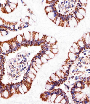 ATP5B Antibody (Center)