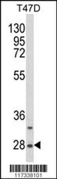 SNRPB Antibody (N-term R49)