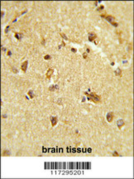 RBM14 Antibody (Center)