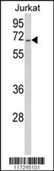 RBM14 Antibody (Center)