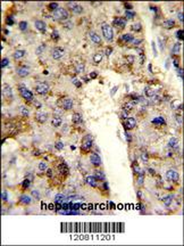 HNRPL Antibody (Center)
