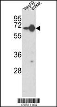 HNRPL Antibody (Center)