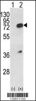 HNRPL Antibody (Center)