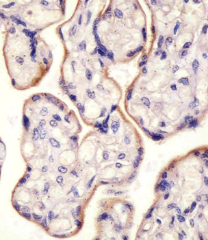 CD71 Antibody (C-term)
