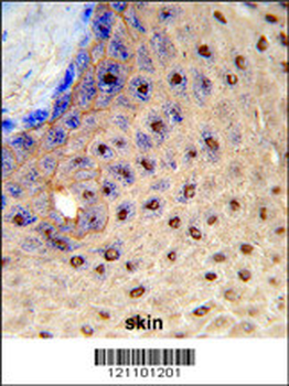PAX3 Antibody (N-term)