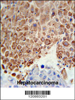 PHGDH Antibody (Center)