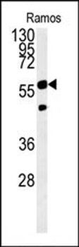 PHGDH Antibody (Center)