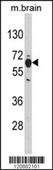 PHGDH Antibody (N-term)