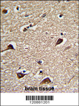PGLS Antibody (C-term)