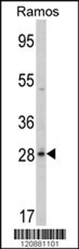 PGLS Antibody (C-term)
