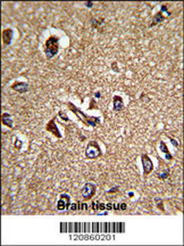 STRAP Antibody (C-term)