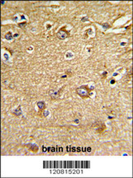 IMMT Antibody (Center)