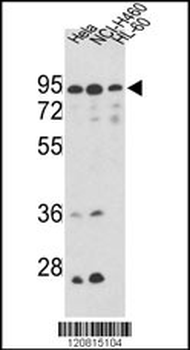 IMMT Antibody (Center)