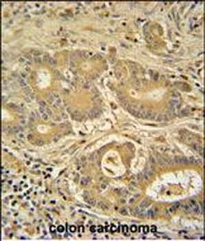 IMMT Antibody (C-term)