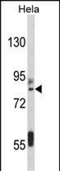 IMMT Antibody (C-term)
