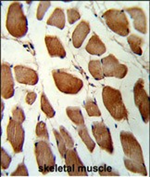 GSTO1 Antibody (Center)