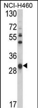 GSTO1 Antibody (Center)
