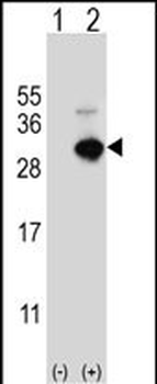 GSTO1 Antibody (Center)