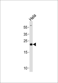 PRDX2 Antibody (Center)