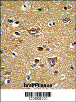 PRDX2 Antibody (C-term)