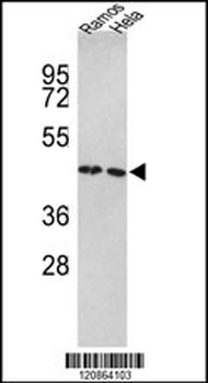 TUFM Antibody (N-term)