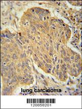 PSMD7 Antibody (C-term)