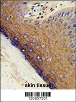 PSMD7 Antibody (N-term)