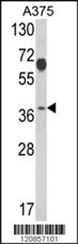 PSMD7 Antibody (N-term)