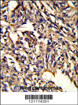 PSMD13 Antibody (C-term)
