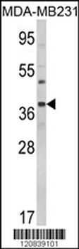 BAG1 Antibody (C-term)