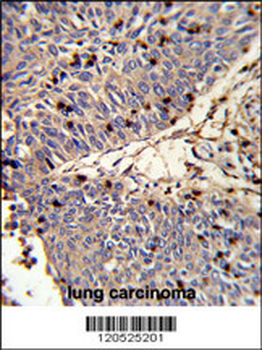 CFL1 Antibody (N-term)