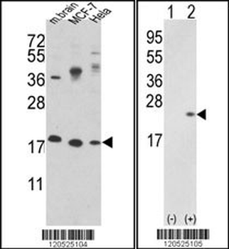 CFL1 Antibody (N-term)