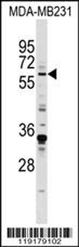 EGR1 Antibody (N-term)