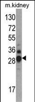 DDAH1 Antibody (C-term)