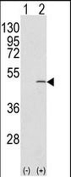 CAPZB Antibody (C-term)