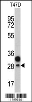 CD201 Antibody (Center)