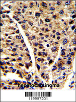 ENOB Antibody (Center)