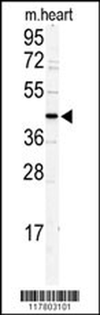 DCC1 Antibody (N-term)