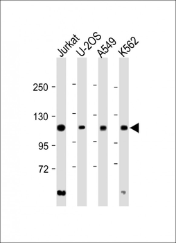 EXO1 Antibody (N-term)