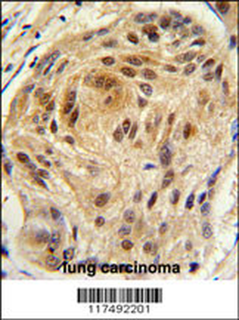 LSM1 Antibody (C-term)