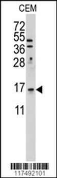 LSM1 Antibody (C-term)
