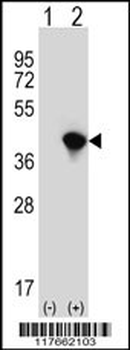 JTV1 Antibody (Center)