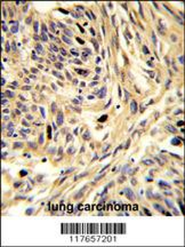 HSPD1 Antibody (C-term)