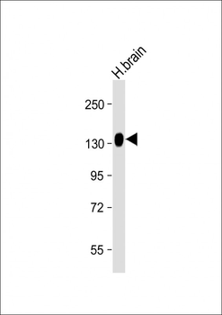 ENPP2 Antibody (Center)