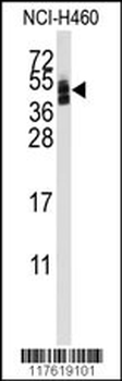 CXADR Antibody (Center)