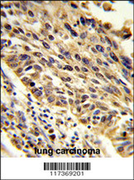 TRIP13 Antibody (N-term)